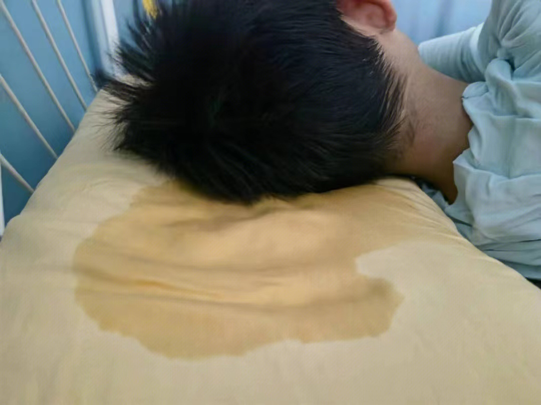 2岁9个月入睡后出汗特别多