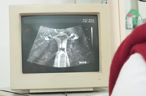 医院B超：CC神秘地带，奇葩剧情，热度爆棚！