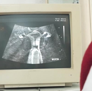 CC神秘地带医院B超室奇葩剧情，颜S惊喜表演！（视频大小/数量）